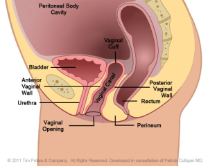 Pelvic cavity post-hysterectomy - Dr Veronikis.