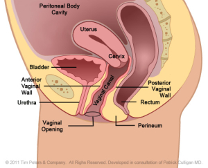 Cystocele-With-Uterus-Image-- Veronikis
