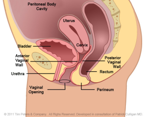 Cystocele-with-Uterus-Veronikis