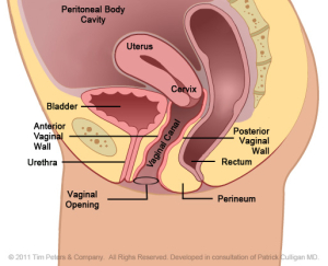 Rectocele w uterus - Dr Veronikis, Dr. Wood - St. Louis